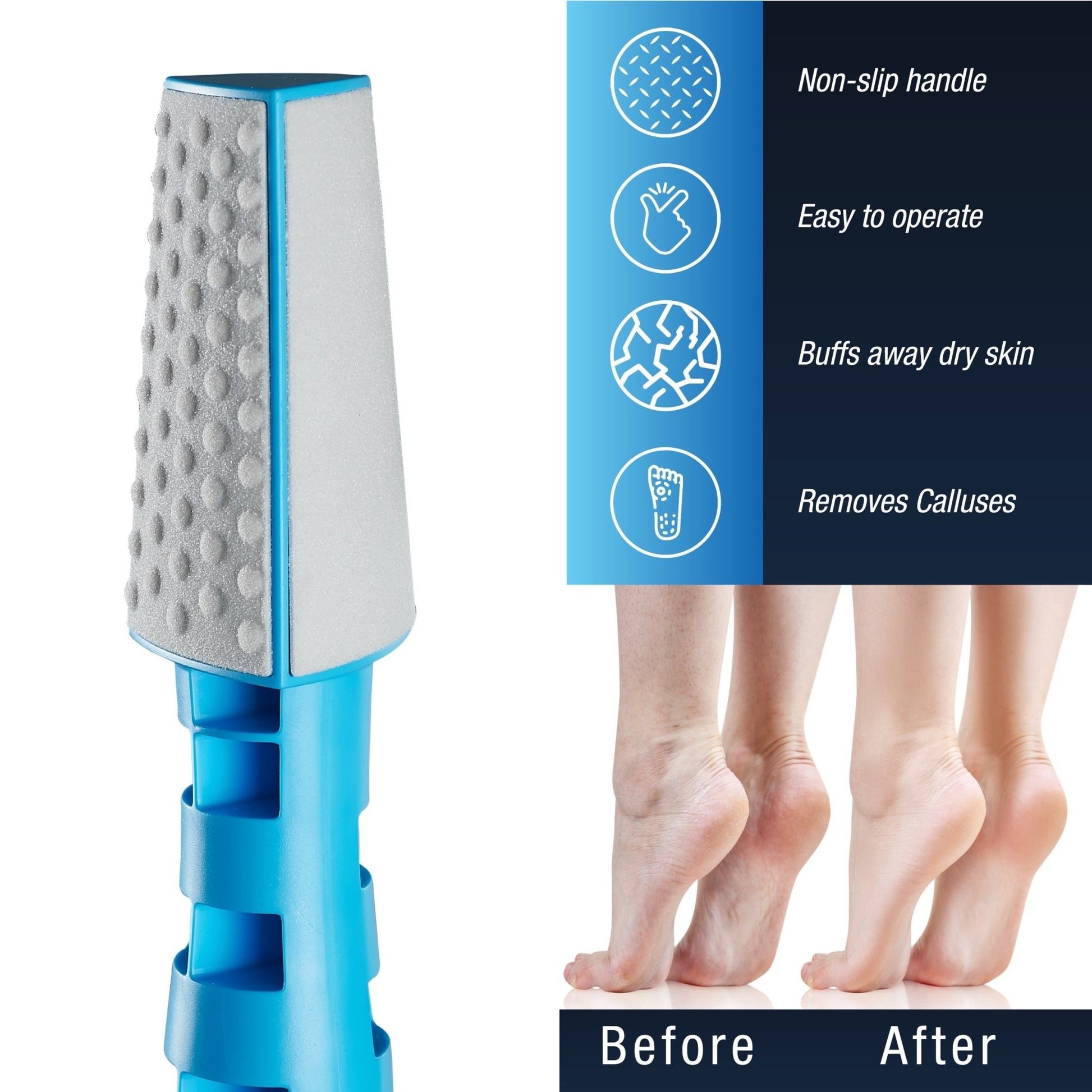 3 In 1 Callus Remover - Couch Potato